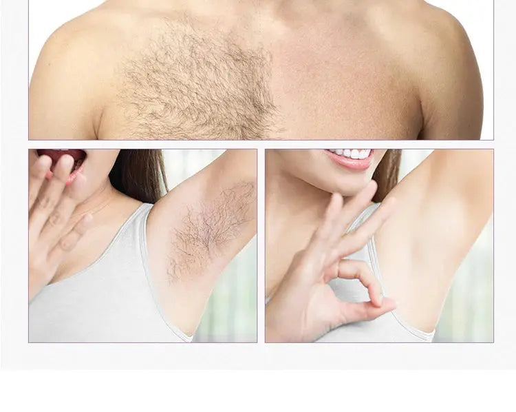 Body Bikini IPL 500,000 Flash épilateur impulsions épilateur Laser mylalla cacyra