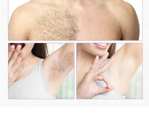 Body Bikini IPL 500,000 Flash épilateur impulsions épilateur Laser mylalla cacyra