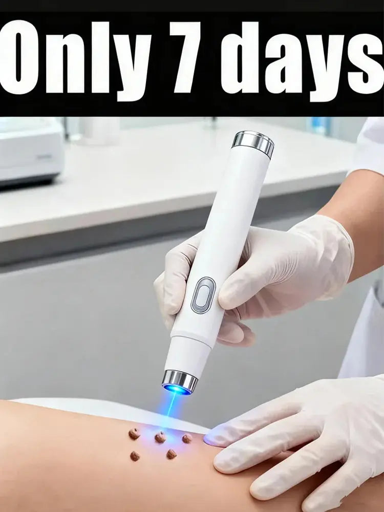 Outil de lumière bleue pour verrues, outil de soins de la peau facile à nettoyer mylalla cacyra