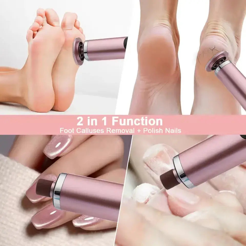 Machine électrique sans fil pour enlever les callosités des pieds, mylalla cacyra